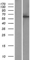 KIAA1984 (CCDC183) Human Over-expression Lysate