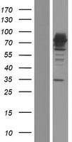 15 Lipoxygenase 2 (ALOX15B) Human Over-expression Lysate