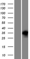 PRPS2 Human Over-expression Lysate