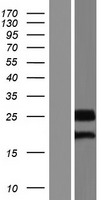 CCDC46 (CEP112) Human Over-expression Lysate