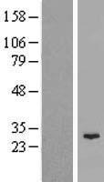 C11orf85 (MAJIN) Human Over-expression Lysate