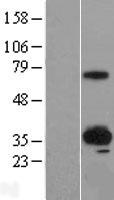 SUSD4 Human Over-expression Lysate
