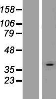 AGPAT3 Human Over-expression Lysate