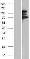 TP53BP2 Human Over-expression Lysate
