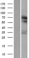 RUFY1 Human Over-expression Lysate