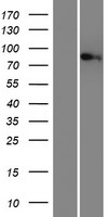 MTMR12 Human Over-expression Lysate