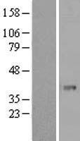 PHF11 Human Over-expression Lysate