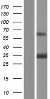 HAGH Human Over-expression Lysate