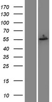 Estrogen Receptor beta (ESR2) Human Over-expression Lysate