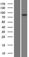DCAMKL2 (DCLK2) Human Over-expression Lysate