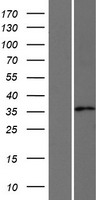 AKR1CL2 (AKR1E2) Human Over-expression Lysate
