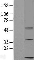 C16orf13 (METTL26) Human Over-expression Lysate