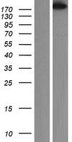 smooth muscle Myosin heavy chain 11 (MYH11) Human Over-expression Lysate