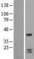 LGALS9C Human Over-expression Lysate