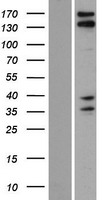 KIAA1543 (CAMSAP3) Human Over-expression Lysate