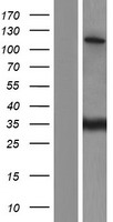 SR140 (U2SURP) Human Over-expression Lysate
