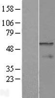 CPEB1 Human Over-expression Lysate