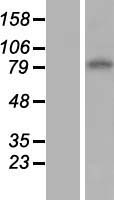 ENT1 (SLC29A1) Human Over-expression Lysate