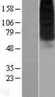 ENT1 (SLC29A1) Human Over-expression Lysate