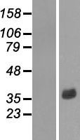 Constitutive androstane receptor (NR1I3) Human Over-expression Lysate