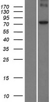POMT1 Human Over-expression Lysate