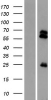 TMPRSS13 Human Over-expression Lysate