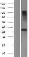 TMUB2 Human Over-expression Lysate