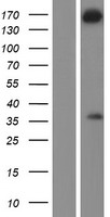WDR62 Human Over-expression Lysate