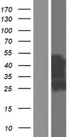 CHMP1A Human Over-expression Lysate