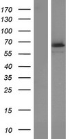TCTN1 Human Over-expression Lysate