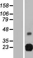 RTBDN Human Over-expression Lysate