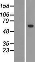 TBX18 Human Over-expression Lysate