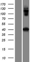 CCDC159 Human Over-expression Lysate