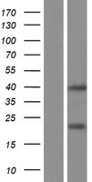 LGALS9B Human Over-expression Lysate