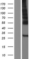 C19orf28 (MFSD12) Human Over-expression Lysate