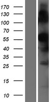 TMPRSS7 Human Over-expression Lysate