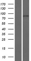 ENGASE Human Over-expression Lysate