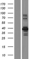 MST4 (STK26) Human Over-expression Lysate