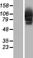 CYLD Human Over-expression Lysate