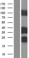 Tropomyosin 3 (TPM3) Human Over-expression Lysate