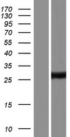 CSKMT Human Over-expression Lysate