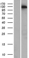 CCDC158 Human Over-expression Lysate