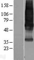 Somatostatin Receptor 1 (SSTR1) Human Over-expression Lysate