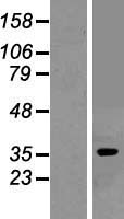 Adenosine A1 Receptor (ADORA1) Human Over-expression Lysate
