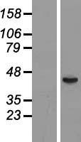 FT1A (FUT6) Human Over-expression Lysate