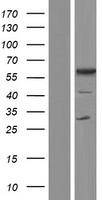 TCP11 Human Over-expression Lysate