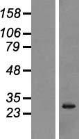 NANOS3 Human Over-expression Lysate