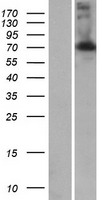 LRRC43 Human Over-expression Lysate