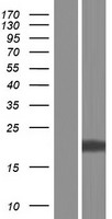 COMMD9 Human Over-expression Lysate