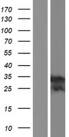 TMEM176B Human Over-expression Lysate